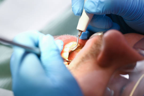 Best Root Canal Emergency Dentist  in Mount Pleasant, TN